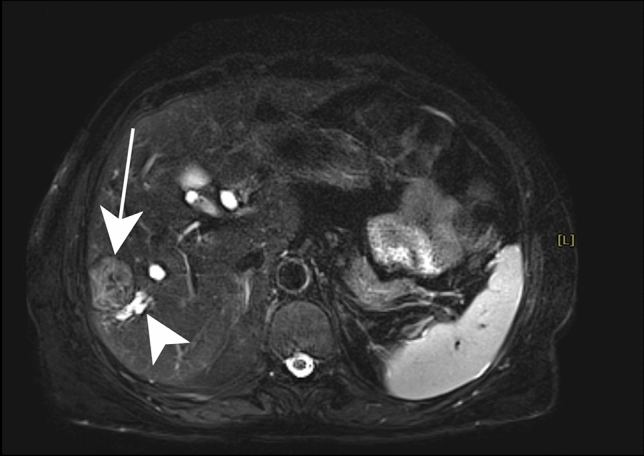 Fig. 12