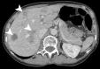 Fig. 4