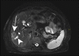 Fig. 12