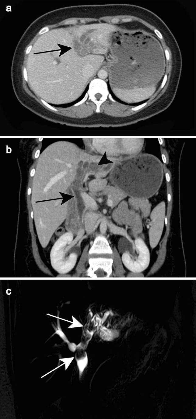 Fig. 19