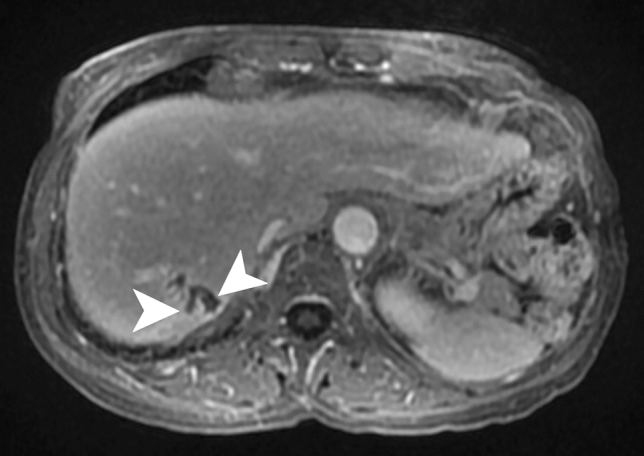 Fig. 20