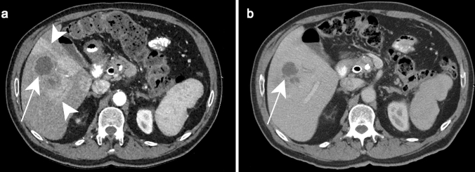 Fig. 1