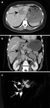 Fig. 19