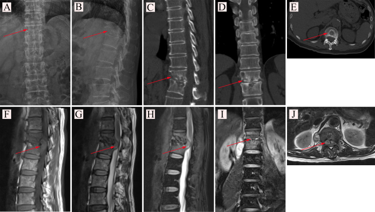 Figure 1