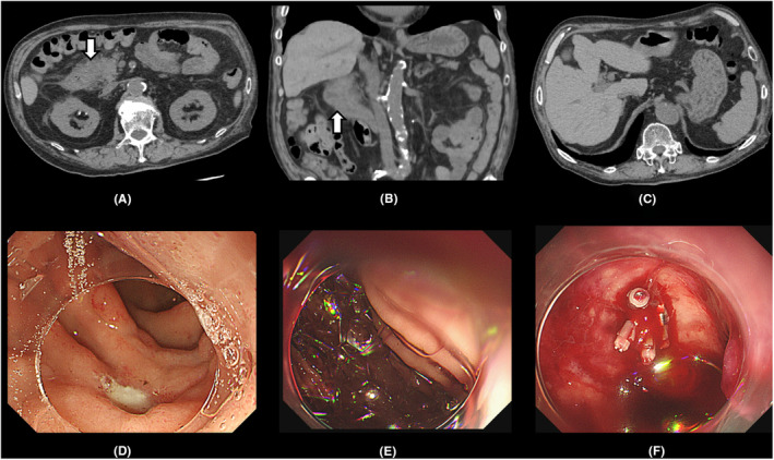 FIGURE 1