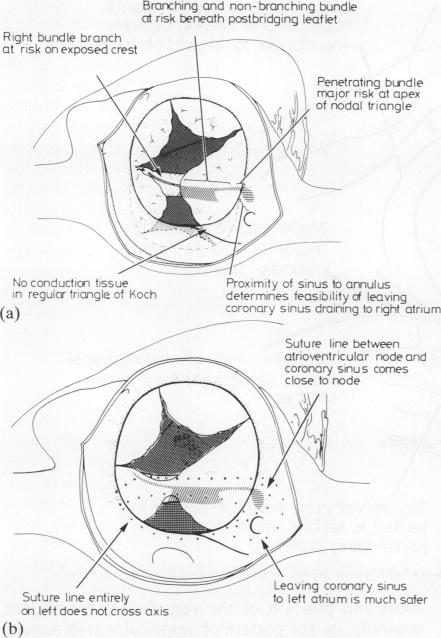 graphic file with name thorax00210-0015-a.jpg