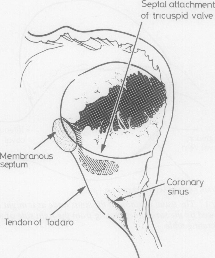 graphic file with name thorax00210-0010-a.jpg