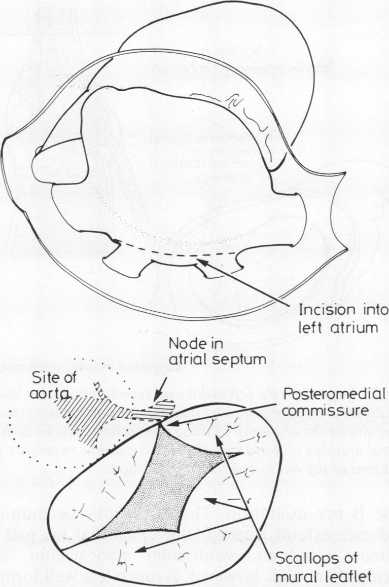 graphic file with name thorax00210-0011-a.jpg