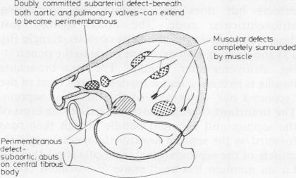 graphic file with name thorax00210-0013-b.jpg