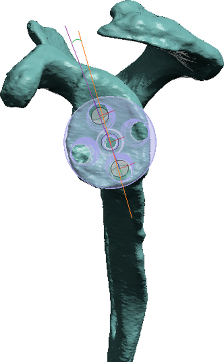 Fig. 3
