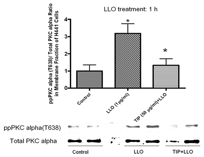 Listeriolysin O Causes ENaC Dysfunction in Human Airway Epithelial ...