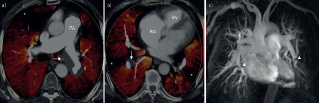 FIGURE 3