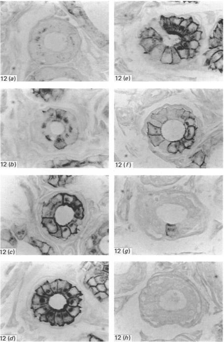 Fig. 12