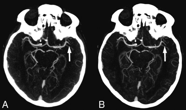 Fig 1.