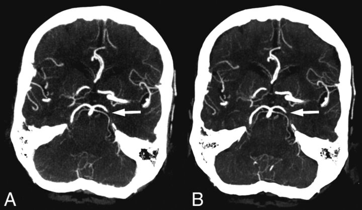 Fig 2.