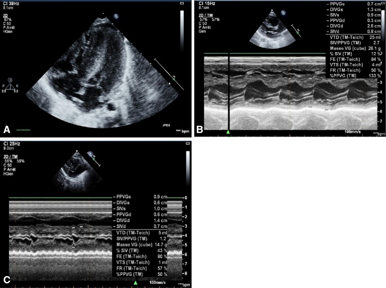 Fig. 1