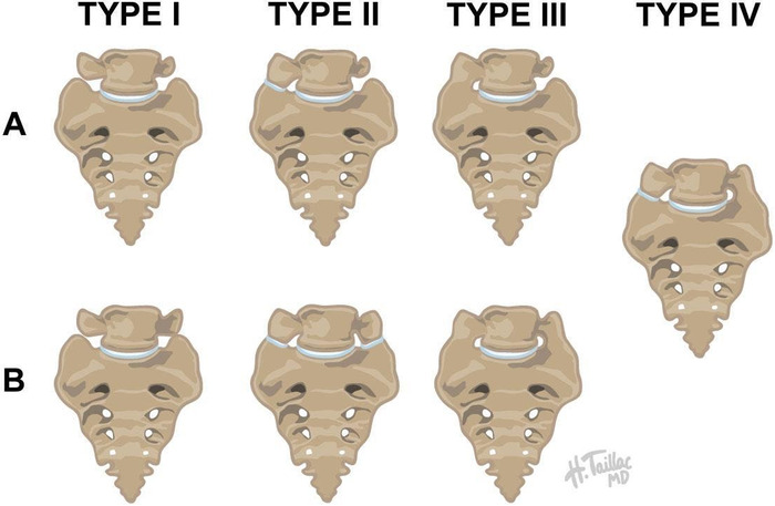 Figure 3.