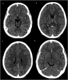 Fig. 10