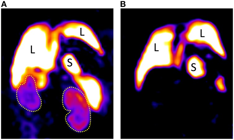 Figure 15