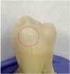 Fig. 11