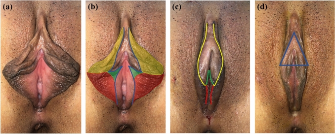 Fig. 3