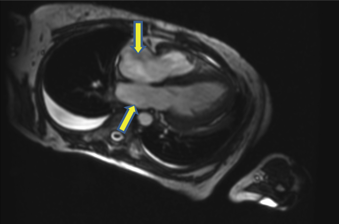 Figure 3