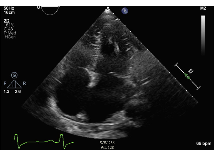 Figure 2