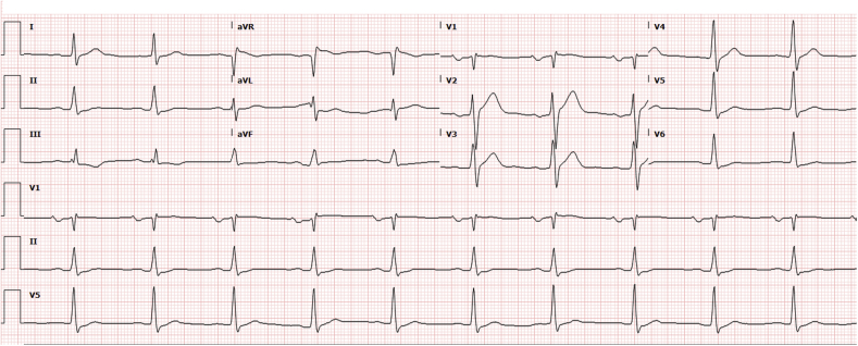 Figure 1