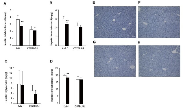 
Fig.2. Hepatic levels of lipids and histological sections in Ldlr−/− and C57BL/6J mice
