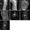 Fig. 1A–G