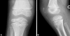 Fig. 5A–B