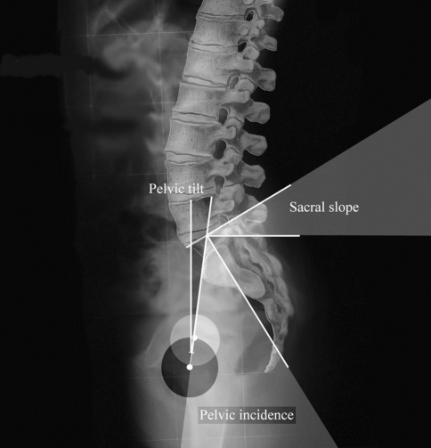 Fig. 1