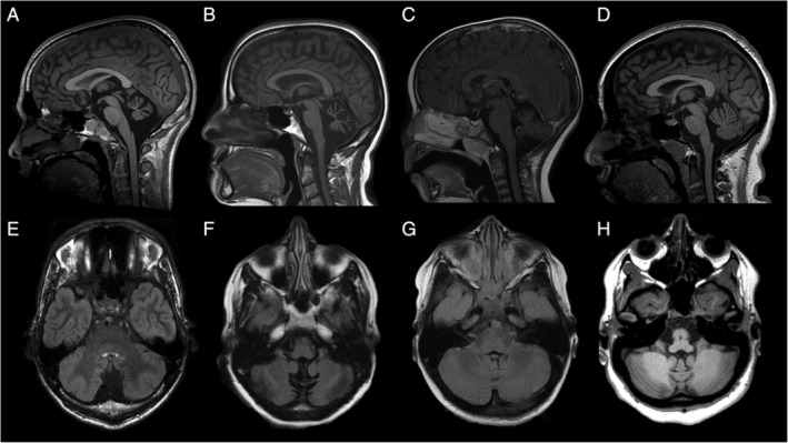 FIG 2