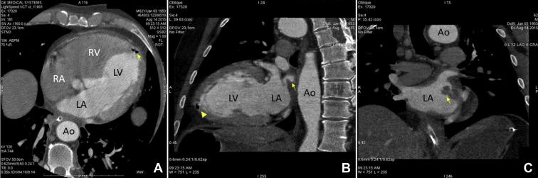 Figure 2