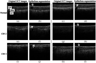 Fig. 10