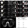 Fig. 11