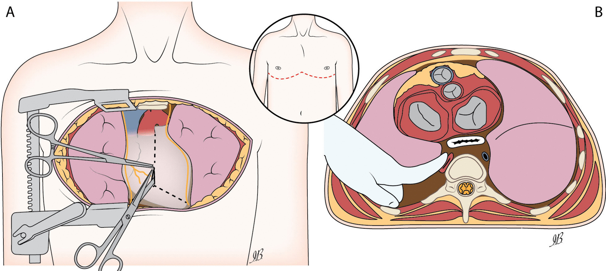 Fig. 2