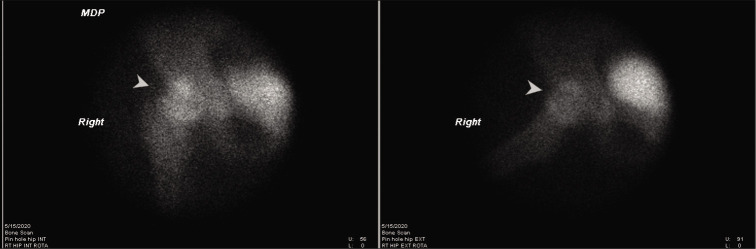 Figure 7:
