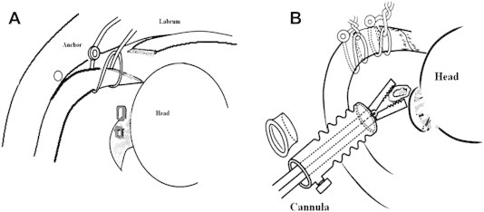 Fig 5