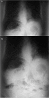Figure 1. a, b.