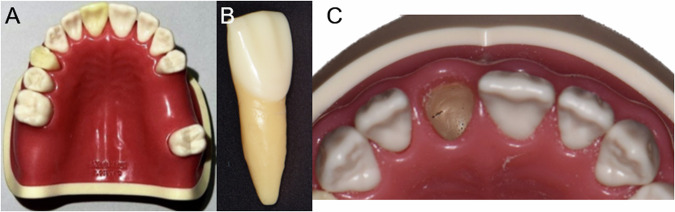 Fig. 1