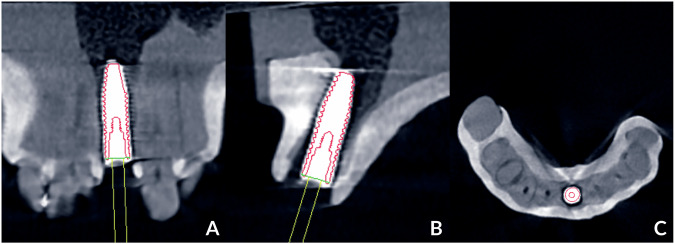 Fig. 3