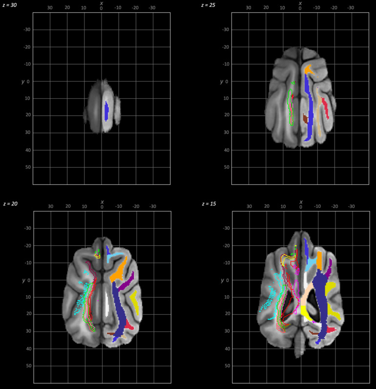 Fig. 3.