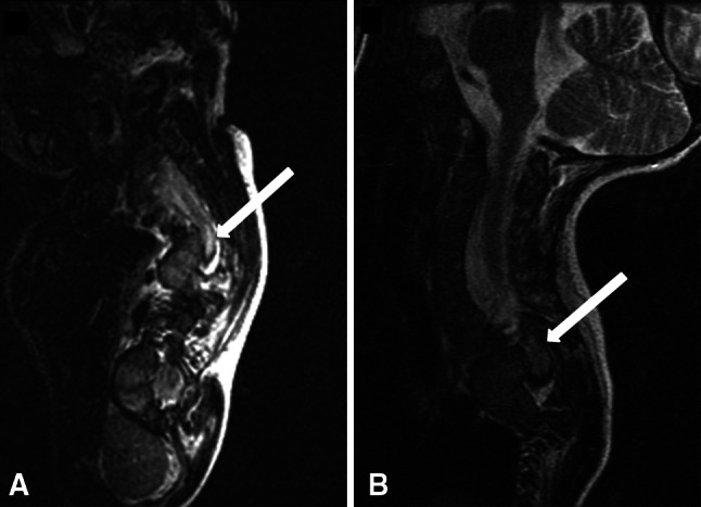 Fig. 2A–B