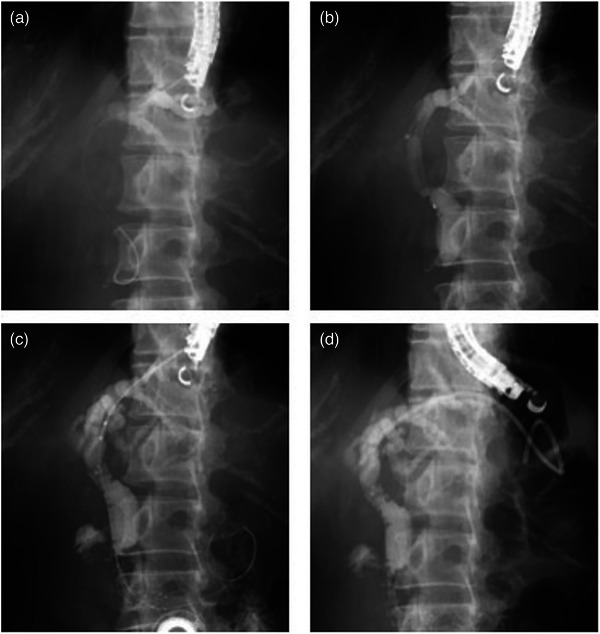 FIGURE 2