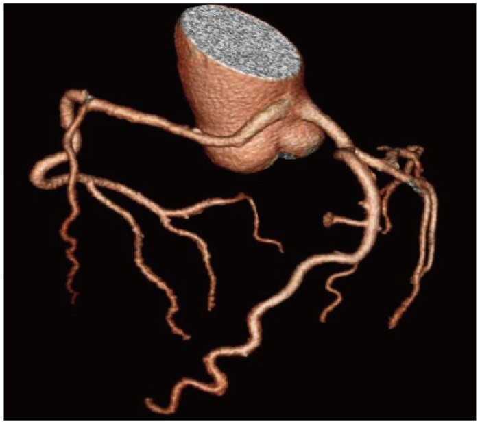 Fig. 3