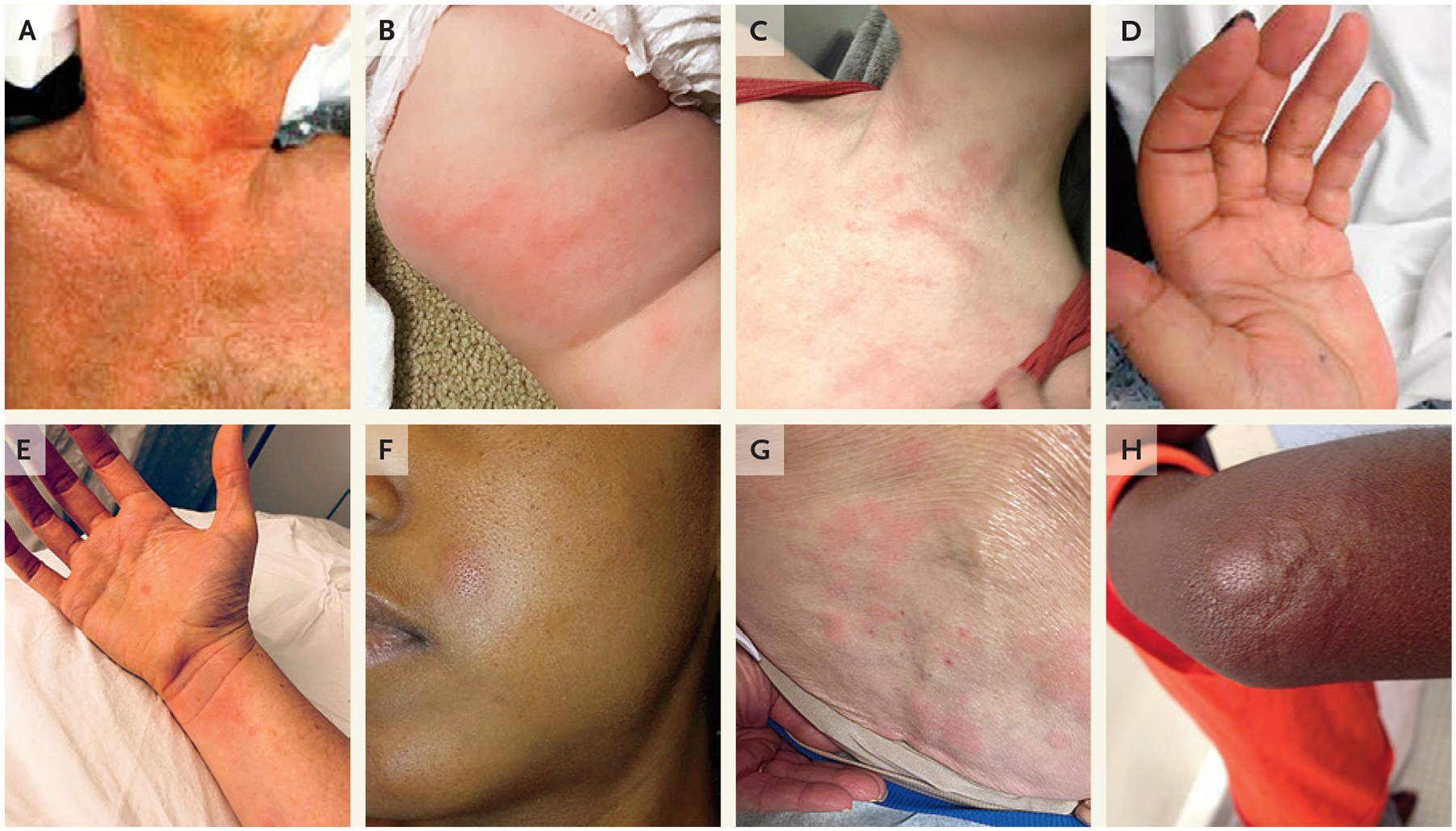 Dermatologic Findings in Patients Varying in Age, Sex, and Skin Color.