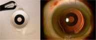 Fig. 14