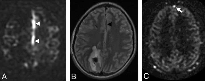 Fig 2.