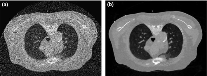 Figure 17